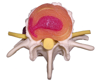 Top view of an intervertebral disc model